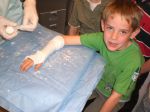 Christoph Mit Gips